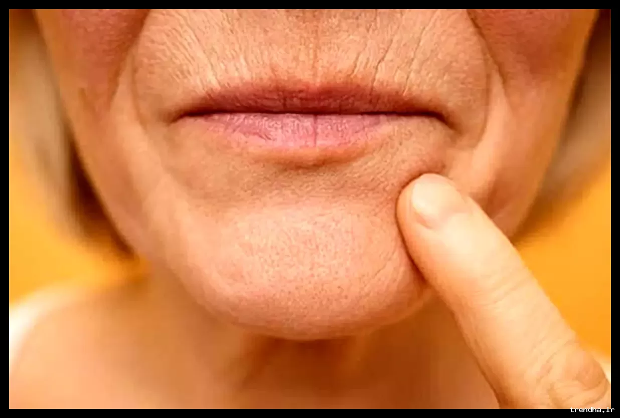 دلایل نازک‌تر شدن لب‌ها با افزایش سن چیست؟